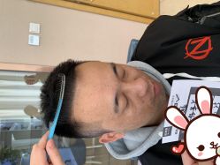 点击看大图 -大麦微针植发丨全国连锁