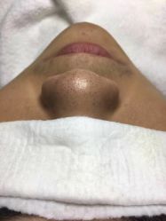 -苑苑vbeauty科技美容SPA