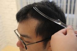 点击看大图 -大麦微针植发丨全国连锁