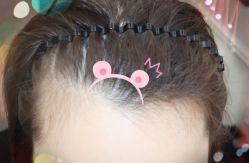 -大麦微针植发全国连锁