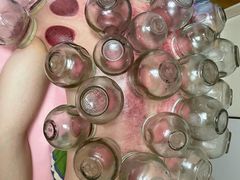-沈师傅盲人按摩工作室(密三小区店)
