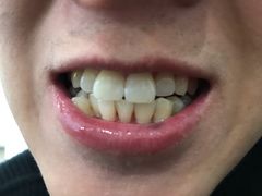 -Dr.Z dental仁康种植矫正中心