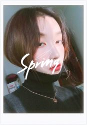 体验后-大麦微针植发全国连锁