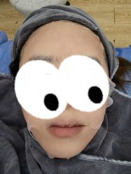 -伊丽莎白医疗美容