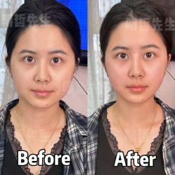 -颜和骨正&明星徒手小颜整骨