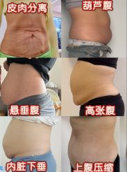 -Fundi张玉珊修身堂·indiba·BTL科技瘦身