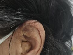 -惠耳听力助听器济南国际听力中心