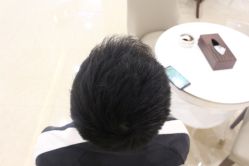 -大麦微针植发丨全国连锁