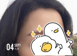 -大麦微针植发全国连锁