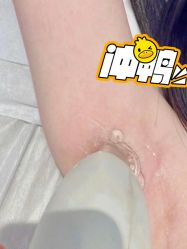 -南京医科大学友谊整形外科医院