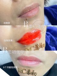 -RC半永久纹眉纹发际线