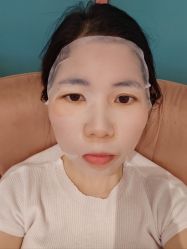 体验后-深圳艺星医疗美容医院