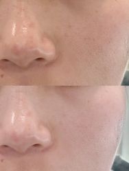 -SKIN79皮肤管理中心