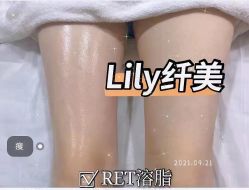 -Lily纤美·科技减脂中心