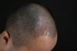 体验后-厦门美莱整形美容医院