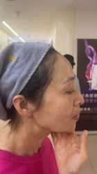 体验后-杭州海亮医院 · 禾芸嘉医美中心