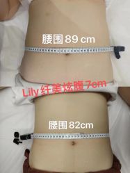 -Lily纤美·科技减脂中心