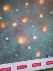 点击看大图 -凡碧诗毛孔清洁收细