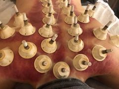 -左悦·艾灸调理·推拿按摩·精油SPA(卓悦汇店)