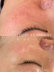 点击看大图 -MLP美丽派·问题肌疗愈中心