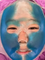 体验后-北京米扬丽格医疗美容·联合丽格鼻整形中心