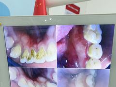 -同步齿科·数字化正畸种植口腔中心(珠海店)