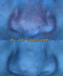 -春田皮肤管理中心品牌旗舰店