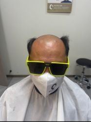 -唐风采假发补发定制