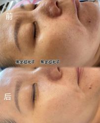 -安吉拉青春化管理中心