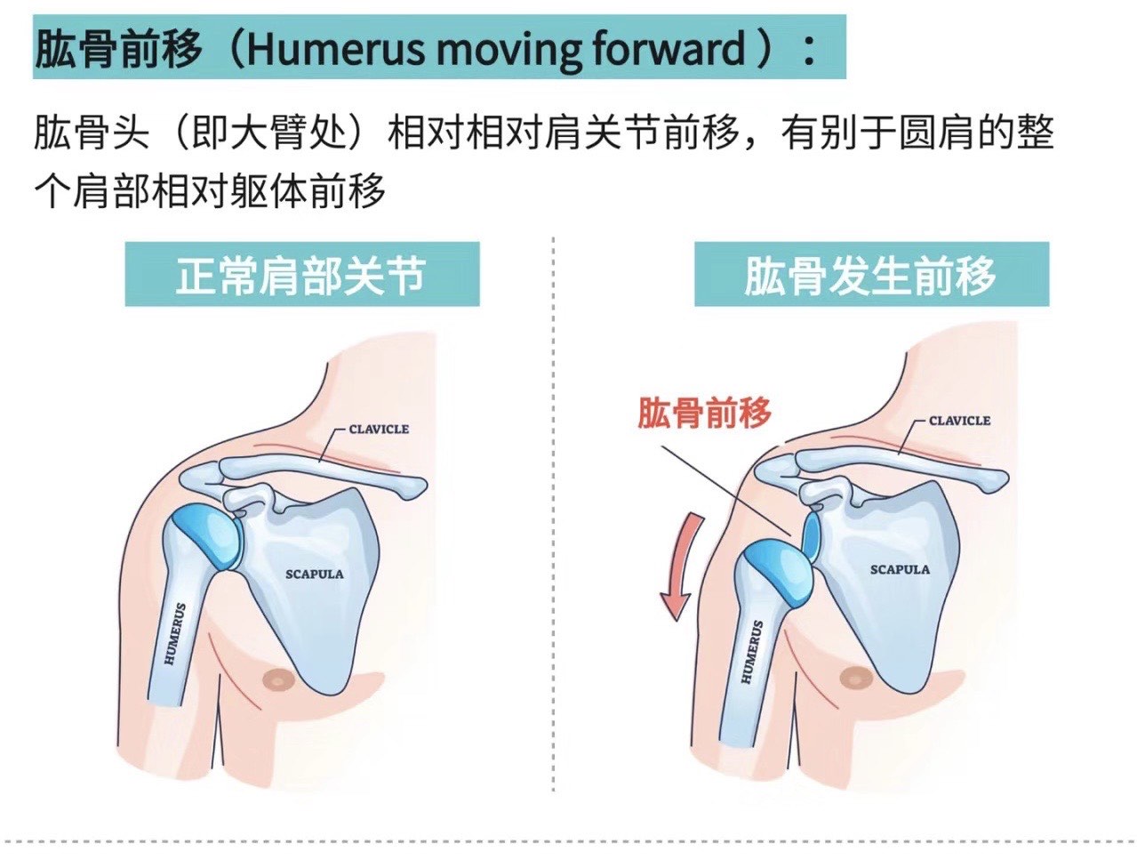 肱三头肌皮褶厚度图片