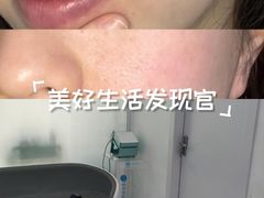 -上置·美兰优湖