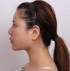 -深圳悦她医疗美容
