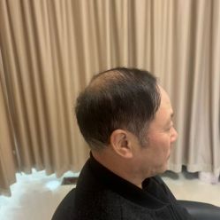 -唐风采假发补发定制