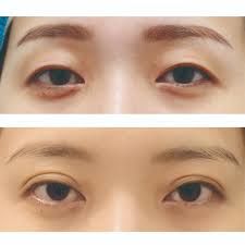 -SKINIST丽铂医疗美容