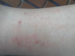 -杭州市第三人民医院