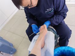 -德哥灰指甲脚气甲沟炎跖疣护理