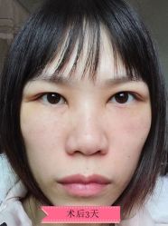 -广州健丽·去眼袋医疗美容机构