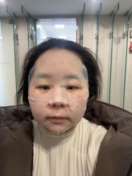 点击看大图 -Yestar艺星整形美容医院