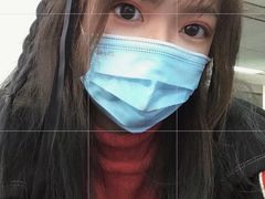 -上海大学附属上海和平眼科医院
