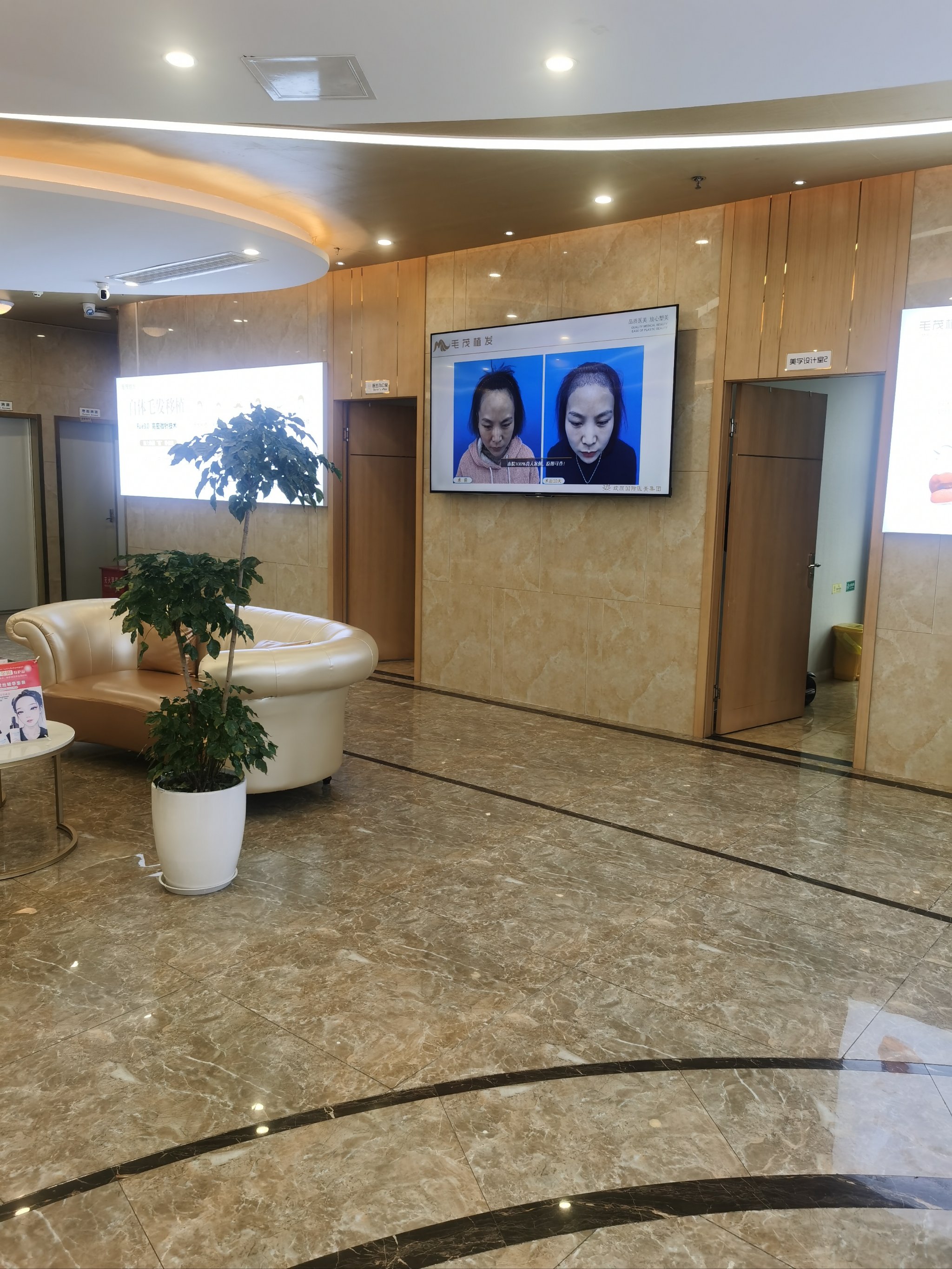 植发区域色差(植发颜色不一致)