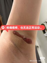 体验后-深圳美莱医疗美容医院