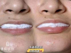 -倩极·精研痘敏肌管理