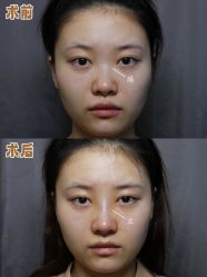 -深圳艺星医疗美容医院