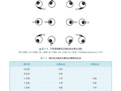 -黑马眼科·近视手术