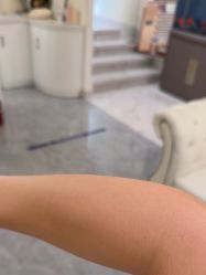 -海涛医疗美容·面部抗衰·注射美鼻