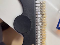 -上海仁爱医院口腔科 · 种植