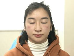 点击看大图 -广东韩妃整形外科医院