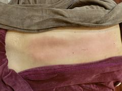 -臻余堂·艾灸·正骨