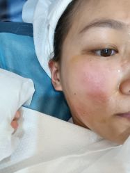 体验后-德媛医疗美容