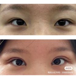 点击看大图 -天津伊美尔医疗整形美容专科医院